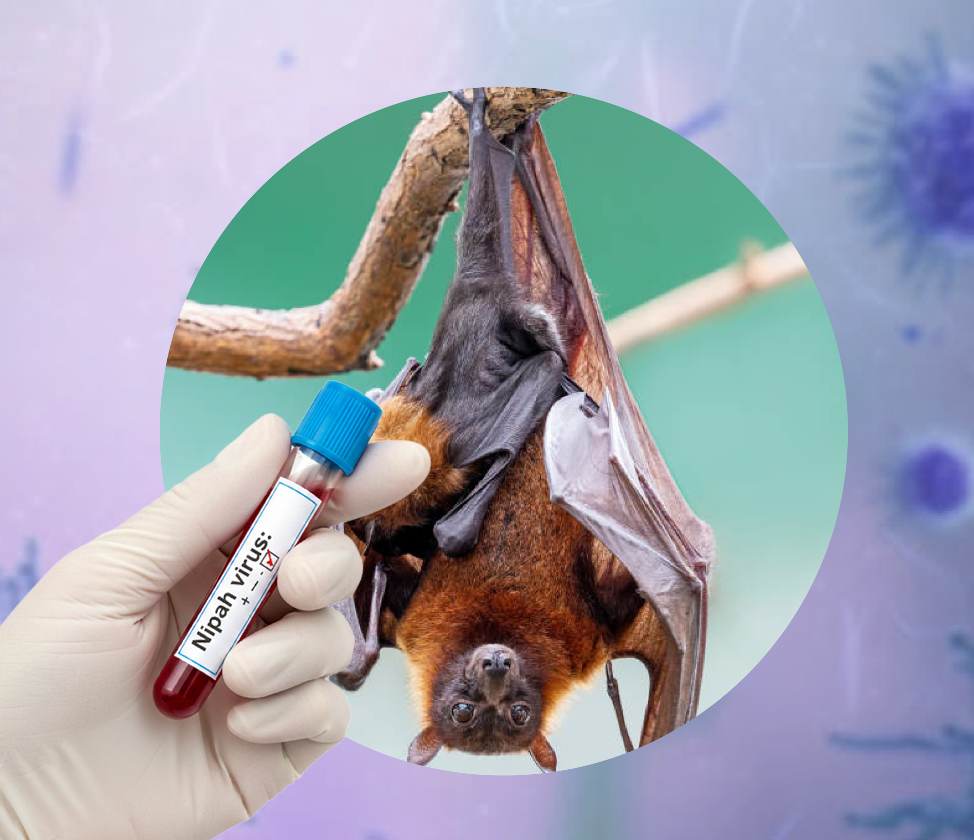 Bộ Sinh Phẩm Chẩn Đoán Nipah